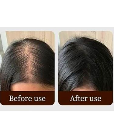 Waverlo Hair Line Powder - Blonde Root Touch Up & Coverage for Thinning Hair | Instant Volumizing & Gray Hair Concealer - Buy Online on GoSupps.com