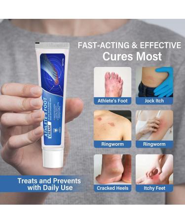 Vifycim Athlete's Foot Cream - Extra Strength Treatment for Athlete's Foot Fungi - Itching & Burning Relief - Buy Online on GoSupps.com