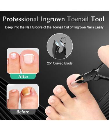 LEYOUFU Toenail Clippers for Seniors | Professional Ingrown Nail Tools | 5-in-1 Heavy Duty Nail Clipper Kit for Thick Nails - Perfect Gifts for Men & Women - Buy Online on GoSupps.com