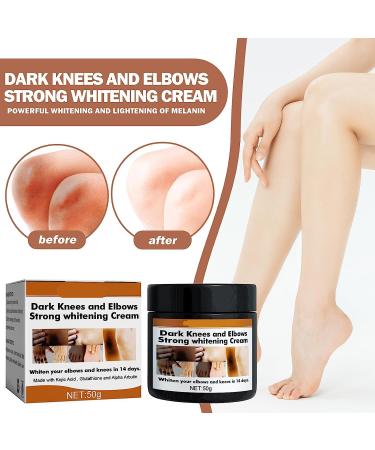 USLEAN 50g Dark Knees and Elbows Whitening Cream | Best 2023 Whitening Body Lotion | Intimate Area Whitening | All Skin Types (100g) - Buy Online on GoSupps.com