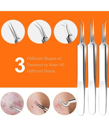 2023 Professional Blackhead & Pimple Popper Tool Kit | 15 PCS Acne Extractor Set with Metal Case - Stainless Steel Blemish Removal Tools - Buy Online on GoSupps.com