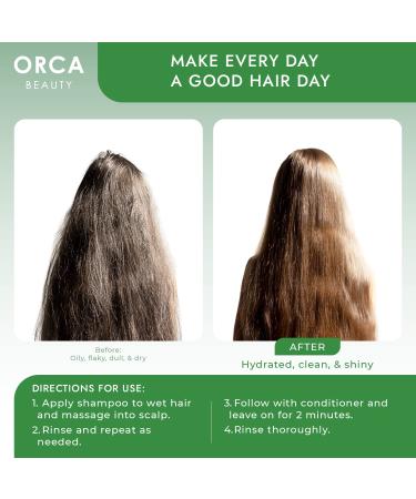 Buy Tea Tree Oil Shampoo for Healthy Hair - Dandruff Oily Hair & Dry Scalp Treatment (16oz) - International Shipping Available - Buy Online on GoSupps.com