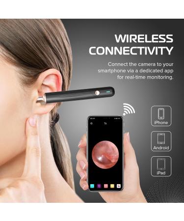 1080P HD Ear Wax Removal Kit with Camera - Wireless Ear Otoscope LED Lights & Tools for iPhone iPad & Android - Buy Online on GoSupps.com