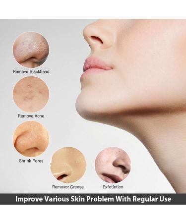DULASP Blackhead Remover Vacuum USB Rechargeable Electric Face Comedo Extractor Kit Blackhead Remover with 4 Adjustable Suction Head for Facial Skin - Buy Online on GoSupps.com
