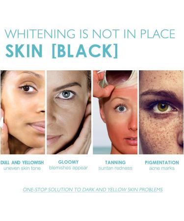 Essence Nourish the Skin Whitening & Moisturizing Essence Facial Whitening Calming and Soothing Essence Facial Whitening Serum Face Serum Reduce Dark Spot Shrink Pores& Improve Skin Tone - Buy Online on GoSupps.com