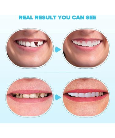 2 PCS Fake Teeth Dentures for Women and Men - Natural and Comfortable Dental Veneers for Temporary Teeth Restoration - Restore Your Confident Smile with Ease - Buy Online on GoSupps.com