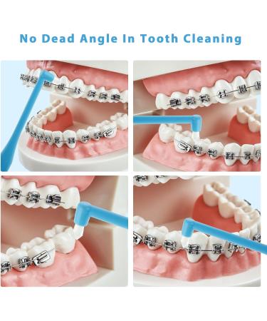 TIESOME Single End Tufted Toothbrush | 5 Pcs Interdental Tooth Cleaner for Orthodontic Detail | Tapered Trim for Precision Cleaning - Buy Online on GoSupps.com