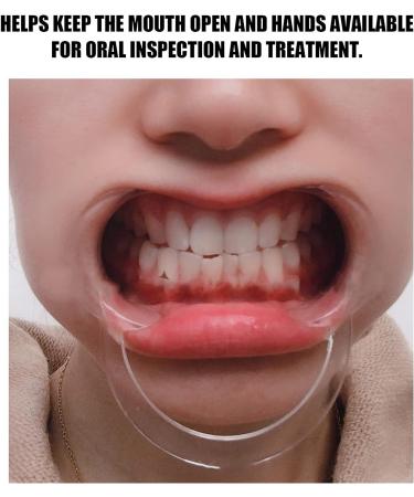 20 Transparent C-Shaped Mouth Openers - Intraoral Lip Cheek Holders for Dental Use | International Shipping Available - Buy Online on GoSupps.com