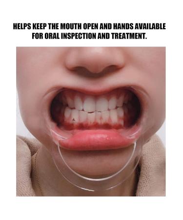 Natudeco 20pcs C-Shape Disposable Cheek Retractors - Orthodontic Lip & Cheek Opener for Teeth Whitening (Medium) - International Shipping - Buy Online on GoSupps.com