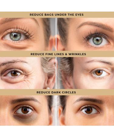 LPH LAB Temporary Eye Tightener Eye Cream - Reduce Under-Eye Bags, Dark Circles & Puffiness - Anti Aging Treatment for Fine Lines - Firming Delicate Skin 0.5 oz - Buy Online on GoSupps.com