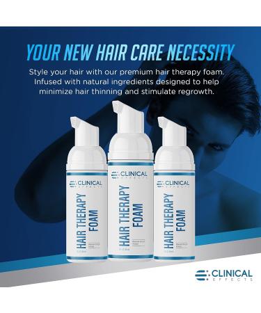 Men's Hair Growth Foam with Peppermint Oil, Saw Palmetto, Avocado Oil - 30ml - Supports Regrowth and Reduces Thinning - Made in USA - Buy Online on GoSupps.com