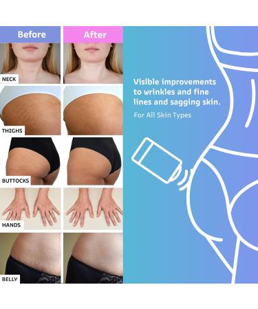 Buy Retinol Body Lotion & Glow Wand | Firming Cream for Neck & Belly | Anti-Aging Solutions for Fine Lines & Skin Tightening - Buy Online on GoSupps.com