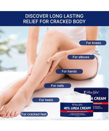 Urea Cream 40% for Intensive Foot Repair & Callus Remover - Softens and Moisturizes Dry Cracked Feet - Buy Online on GoSupps.com