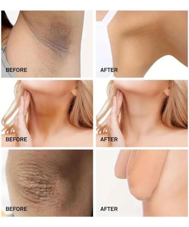 Anloximt Armpit Cream Armpit Cream for Underarm Skin Underarm | Natural Brightening Cream for Underarm Dark Skin for Face Neck Knee Body - Buy Online on GoSupps.com