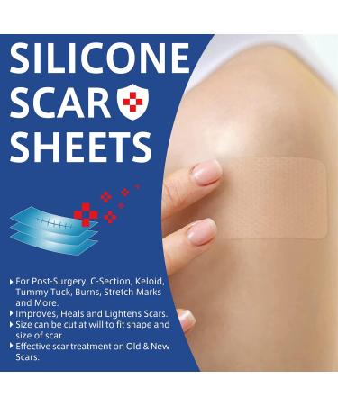 Silicone Scar Sheets (1.6 x 120 Roll) - Medical Grade Scar Tape for Acne, C-Section & Keloid Scars - Buy Online on GoSupps.com