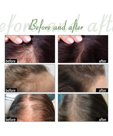 Anshka Silvercare Hair Care Eyebrow Essence AntiDropping Nutri Hair Care Eyebrow Essence Moisturizing Dense Hair Essence for Dry Damaged Hair & Growth 1pc - Buy Online on GoSupps.com