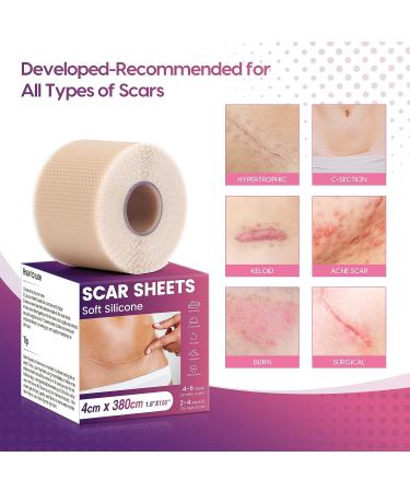 Morfone Silicone Scar Tape - Professional 1.6 x 150 Roll for Effective Scar Removal - C-Section, Surgery, Burn, Keloid, Acne - Waterproof - Buy Online on GoSupps.com