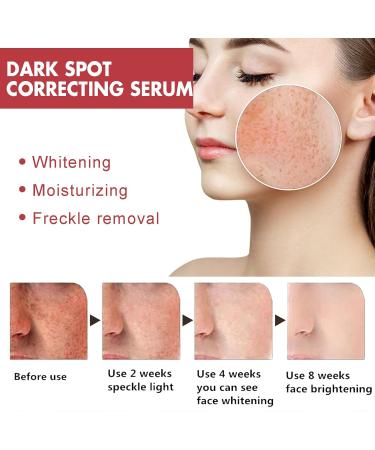 Trendyfave Dark Spot Serum Niacinamide Serum Brightening Serum 10% Niacinamide+ 4% Tranexamic Acid Dark Spot Corrector For Face Age Spot Remover For Face Face Redness Remover Arbutin Serum - Buy Online on GoSupps.com