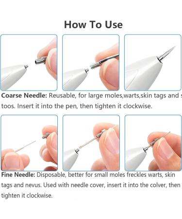 Skin Tag Removal Pen | Portable Mole & Wart Remover Tool with 9 Strength Levels | LED Display & Light | Home Use Spot & Freckle Removal - Buy Online on GoSupps.com
