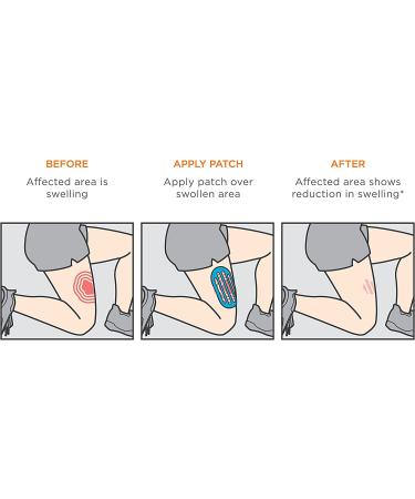 KT Tape Recovery Patch - Swelling Relief Tape for Rapid Recovery - Buy Online on GoSupps.com