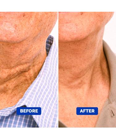 Men's Particle Neck Firming Cream - Anti Aging Triple Action with Collagen, Hyaluronic Acid & Retinol | Lift, Moisturize and Tighten Saggy Skin | 50 ml - Buy Online on GoSupps.com