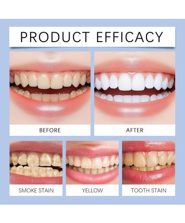 Cleaning Toothpaste - Strengthens Tooth Surfaces & Boosts Wear Resistance Improves Tooth Color Protects Gums Twice Daily Use (Morning & Night)(5PCS) - Buy Online on GoSupps.com