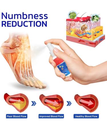 Gfouk Numbfix Hands and Foots Spray for Discomfort Caused by Joints Numbfix Hands and Foots Spray Relieves Various Joint Pains (2pcs) - Buy Online on GoSupps.com