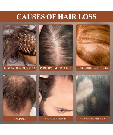 Botana Hair Growth Oil Batana Oil Organic Organic Batana Oil Pure Raw Batana Oil For Hair Growth Repair Damaged Hair Hair Smoothing Conditioner for Damage Protective for Men Women - Buy Online on GoSupps.com