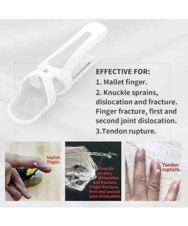 Buy Finger Splint Protector & Joint Immobilizer Sleeve - Set of 3 for Instant Finger Support | International Shipping Available - Buy Online on GoSupps.com