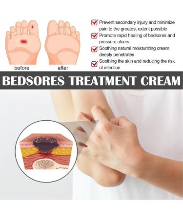 5 Bedsore Cream Fast Wound Healing Gel Pressure Sor e Relief Cream Bedsore Wound Care Cream Soothing Relief Of Bed Soress Bed So re Cream Fast Acting Bedsore Ointment Bed Soress Care Cream 20g - Buy Online on GoSupps.com