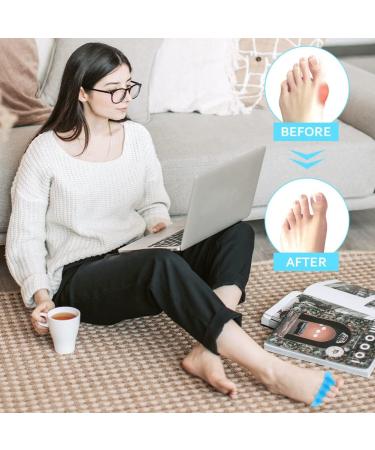 Durable Toe Separators for Bunions & Hammertoes - 6 Pairs for Men and Women | Treat Plantar Fasciitis, Toe Spacers Set - Buy Online on GoSupps.com