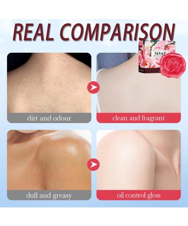 Rose Soap Handmade Soap Bar Natural Soap with Rose Essential Oil Facial Soap Bar Cleanser Suitable for All Skin Types Face & Body Cleansing Hydrating Moisturising Exfoliating Vegan & Residue-Free 1 - Buy Online on GoSupps.com