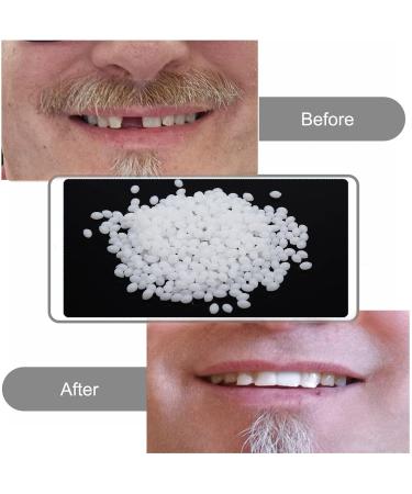 Flipped Warmth Provisional Dentures | Temporary Tooth Repair Kit | DIY Vampires Fake Dentures | Dental Prosthesis for Quick Fix - Buy Online on GoSupps.com