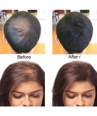 Sevich Hair Fibers - 100g Chestnut Brown Hair Building Fibers | Natural Keratin for Thin Hair - Original Refill - Buy Online on GoSupps.com