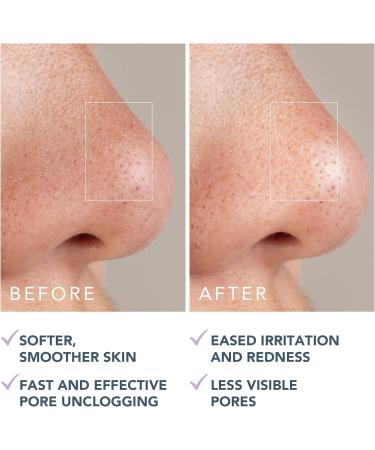 FOREO KIWI Active Pore & Blackhead Mask 100g - Blackhead Remover - Clay Mask & moisturizing Jojoba Oil - Pore Minimizer - Skin Purifying & Detox Face Mask - Vegan & Cruelty-free - All Skin Types - Buy Online on GoSupps.com