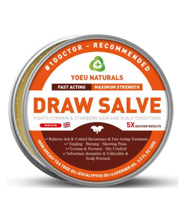 Heat Rash Cream Jock Itch Hand Foot Fungus Tinea Versicolor Itchy Feet Butt Anal Itch Psoriasis Scalp Dandruff Bee Sting Bites Boil Cyst Armpit Adults Kids Hidradenitis Suppurativa Treat 3.52 Fl Oz 24h Fast Acting-MAX STRENGTH