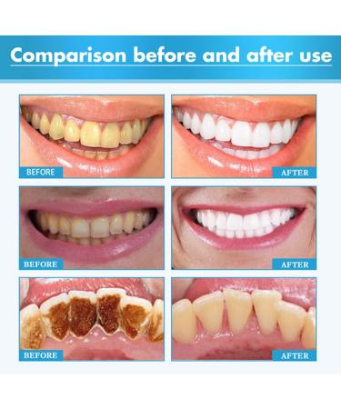 Awzlove Teeth Total Care Mouthwash - All-in-One Oral Solution for Whitening & Deep Cleaning (2 Pcs) - Buy Online on GoSupps.com