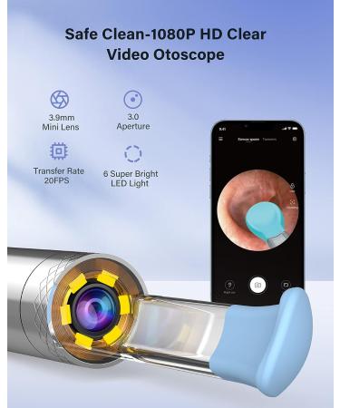 BEBIRD C3 Ear Cleaner - Wireless Otoscope 1080P HD Waterproof Endoscope for Ear Wax Removal - 6 LED Light, Mom Gadgets - White - Buy Online on GoSupps.com