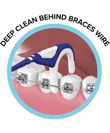 OrVance Braces Flosser - Designed for Braces for an Easy & Effective Clean Ultra Strong Floss - 40 Count (Pack of 2) - (Packaging May Vary) 20 Count (Pack of 2) - Buy Online on GoSupps.com