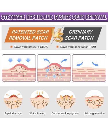 Silicone Scar Sheets Medical Grade Silicone Scar Tape - Size 1.5M - Buy Online on GoSupps.com