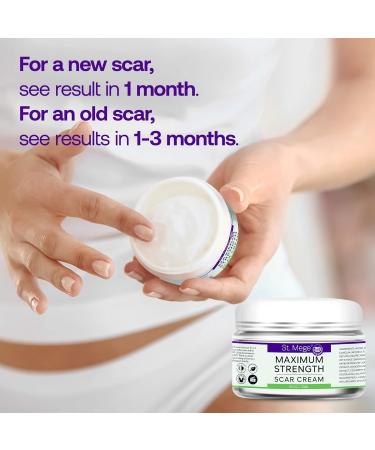 Maximum Strength Stretch Mark Cream | Scar Treatment for Old & New Scars | C-Section Recovery Cream - Buy Online on GoSupps.com