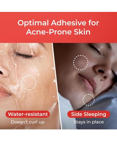 Sosky Pimple Patches - Invisible Hydrocolloid Acne Stickers with Salicylic Acid | 192 Count for Zits & Blemishes - Buy Online on GoSupps.com