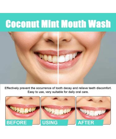 Coconut Mint Oil with 7 Essential Oils & Vitamins D E K2 - Fresh Breath Oralhoe Mouthwash (1 Bottle) - Buy Online on GoSupps.com