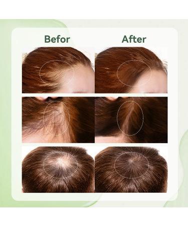 Shop Hair Rosemary Oil & Scalp Applicator Kit | 2oz Hair Growth Set for Men & Women | Nourishing Hair Treatment - Buy Online on GoSupps.com