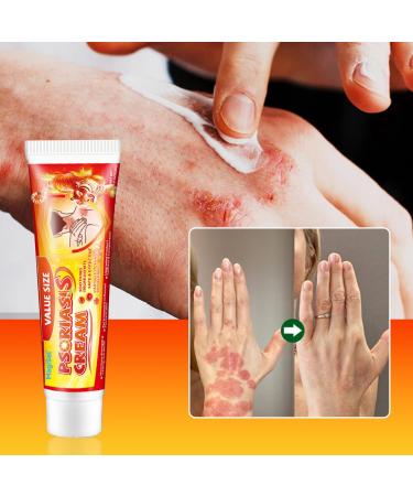  MagiSel Anti-itch ointment skin cream soothing skin cream for itching and psoriasis natural care formula cares for and soothes the skin suitable for skincare - Buy Online on GoSupps.com