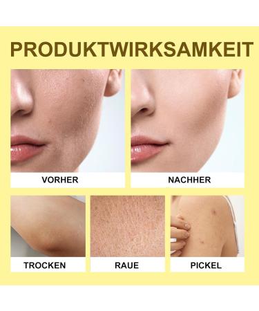 MEITREND Shea butter shea butter cream natural body butter deep acting for all skin types hair moisturizer for dry and cracked skin - Buy Online on GoSupps.com