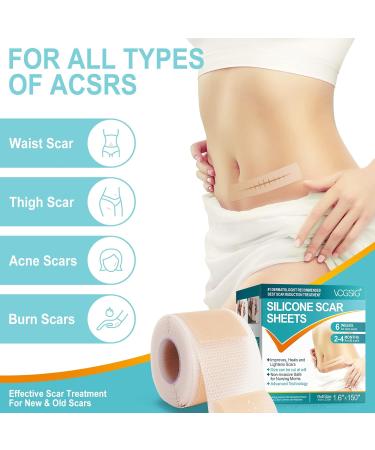 VOGSIG - Silicone Scar Sheets 1.6” x 150” Silicone Scar Tape - Buy Online on GoSupps.com