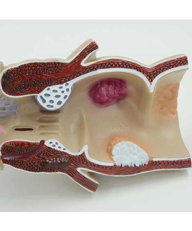 Human Rectal Hemorrhoid Lesions ical Model Colon Anal Sphincter Anorectal Teaching Specimen - Buy Online on GoSupps.com
