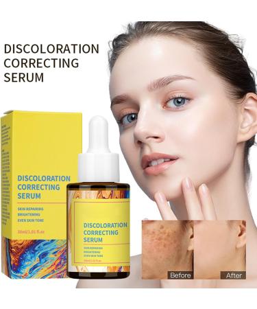 Dark Spot Correcting Glow Serum - Dark Spot Remover for Face - Nicotinamide Serum for Fade Acne Marks - Face Serum to Even Skin Tone & Shrink Pores - Face Moisturiser Skin Care for All Skin Types - Buy Online on GoSupps.com