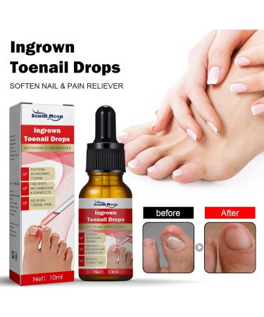 Ingrown Toenail Treatment Oil - Cuticle Care for Ingrown Toenails, Nail Fungal Treatment - 10ml - Buy Online on GoSupps.com